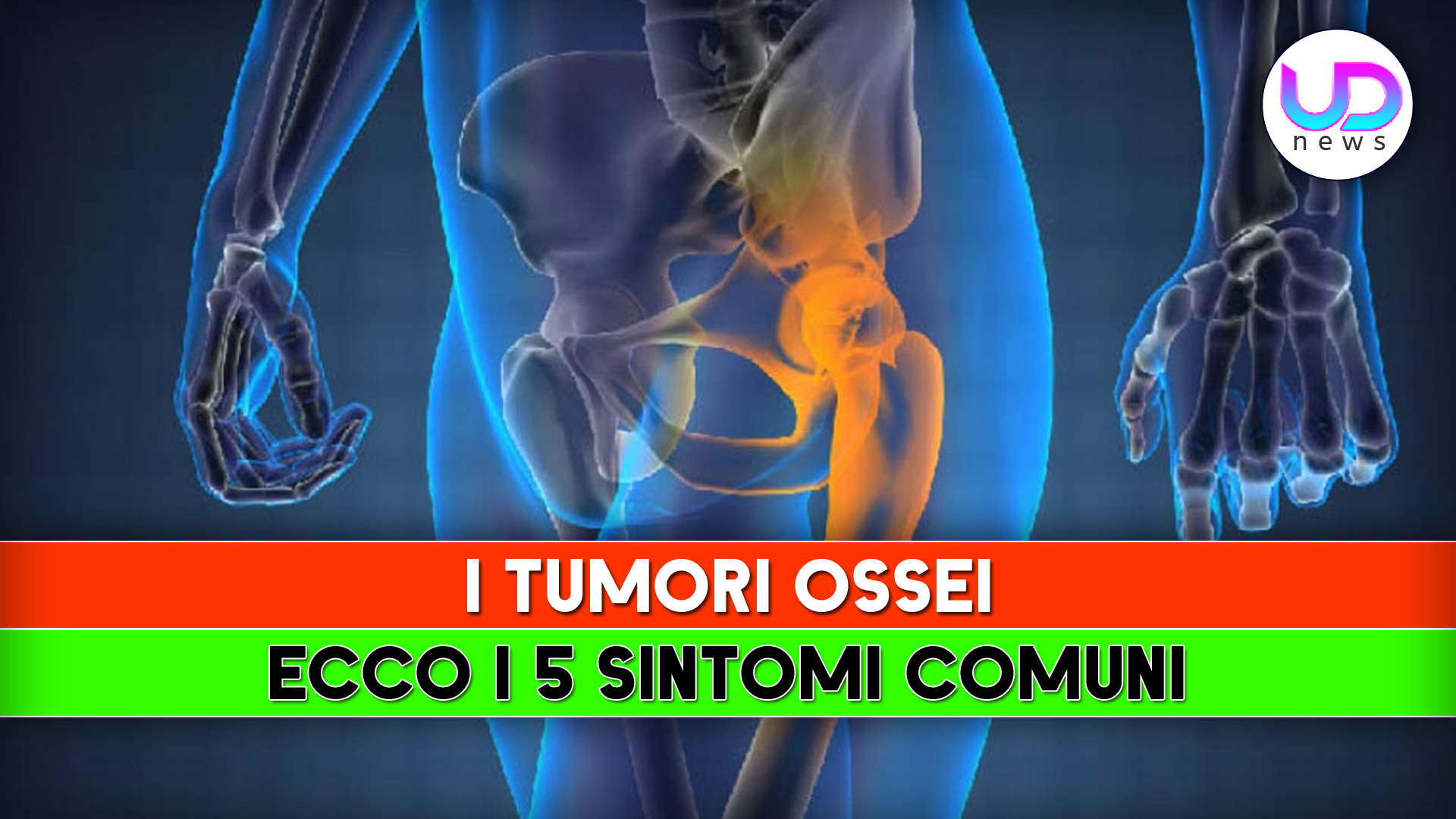 Tumeurs osseuses : voici les 5 symptômes courants !