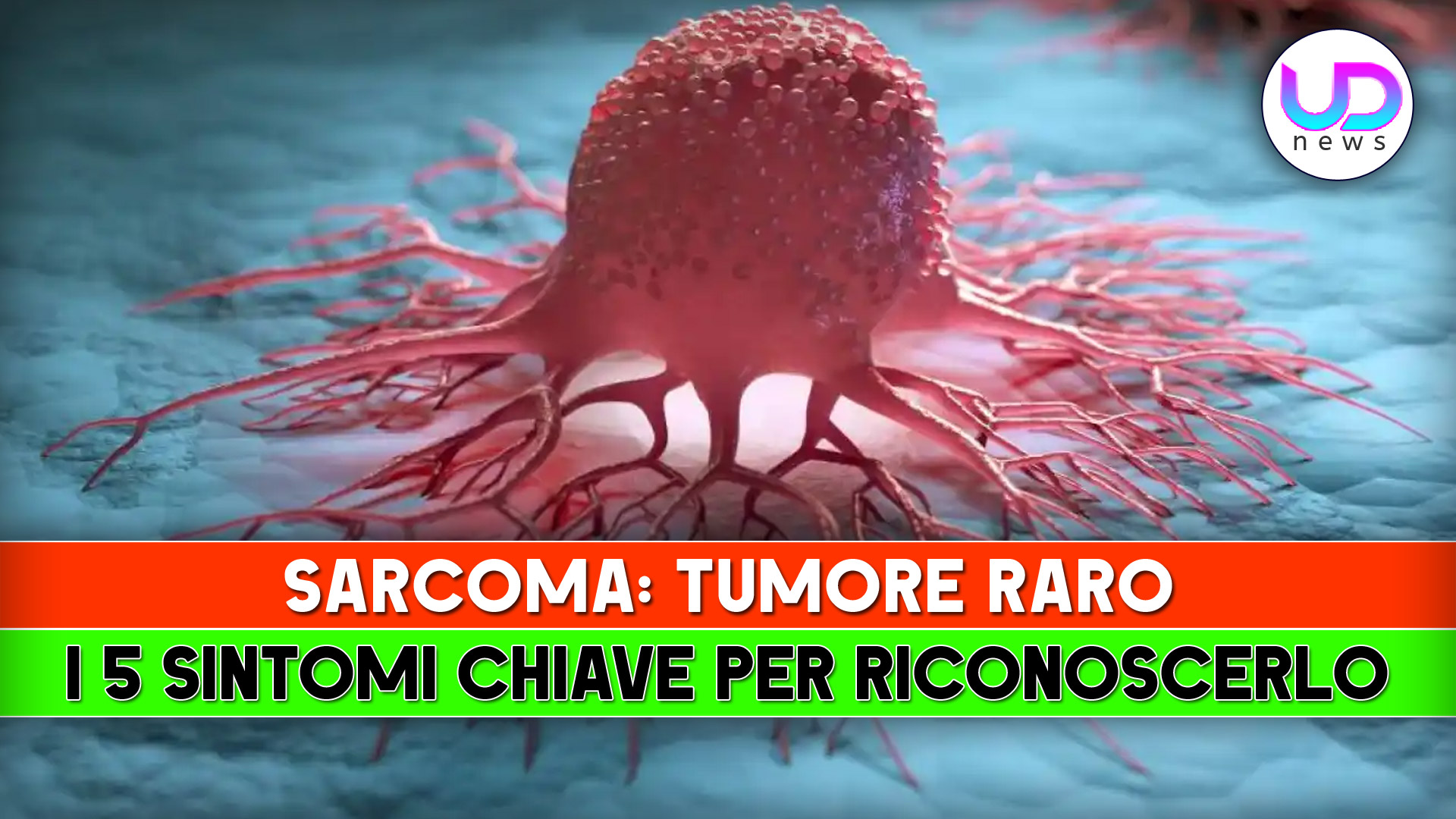 Sarcoma Rare Tumor 5 Key Symptoms For Early Recognition Breaking sarcoma-rare-tumor-5-key-symptoms-for-early-recognition-breaking