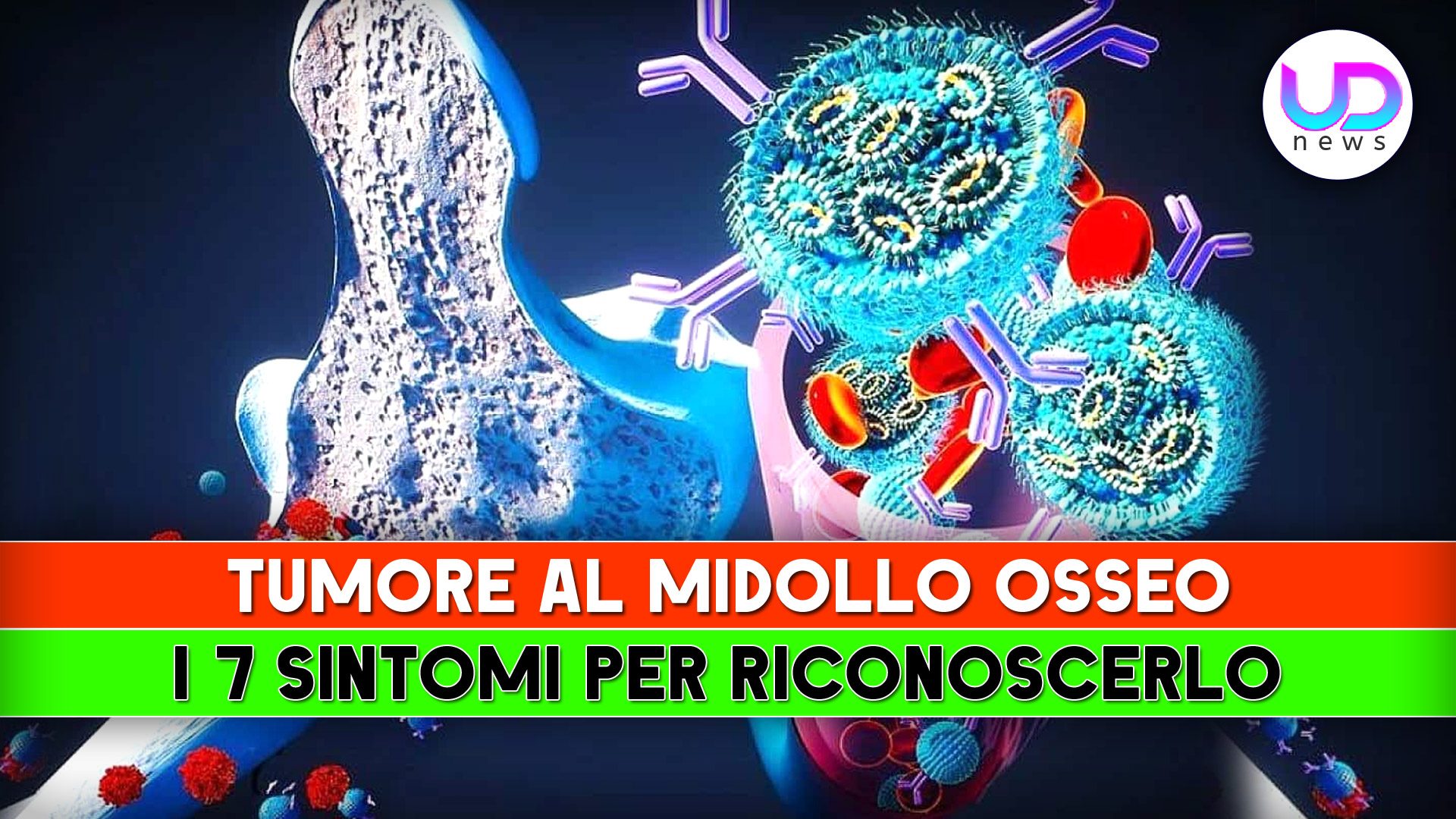 Tumore Al Midollo Osseo: I 7 Sintomi Per Riconoscerlo!