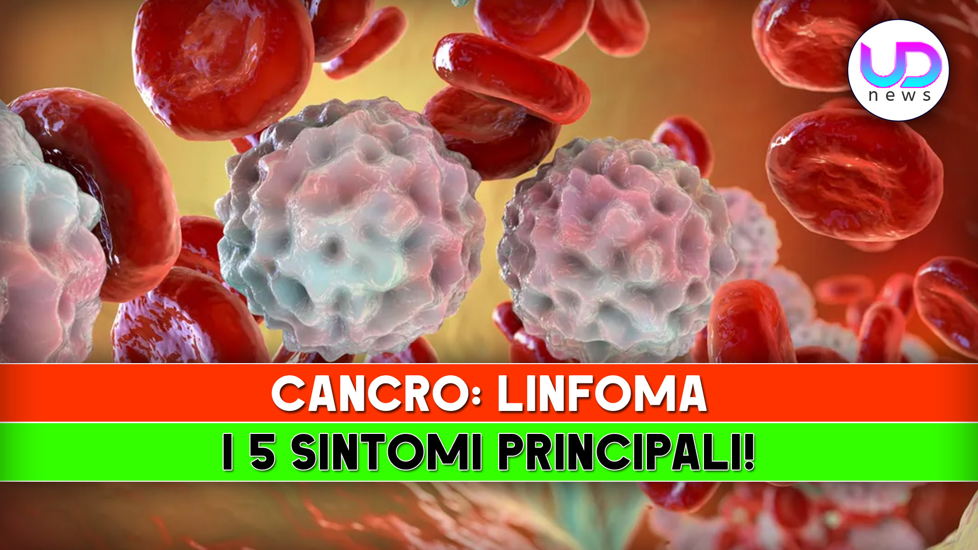 Cancro Linfoma