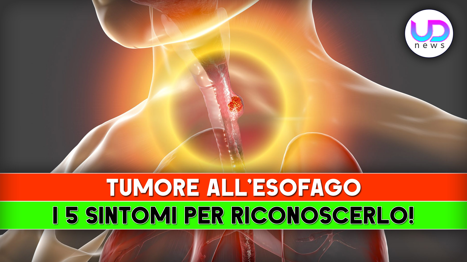 Tumore All’Esofago: I 5 Sintomi Per Riconoscerlo!