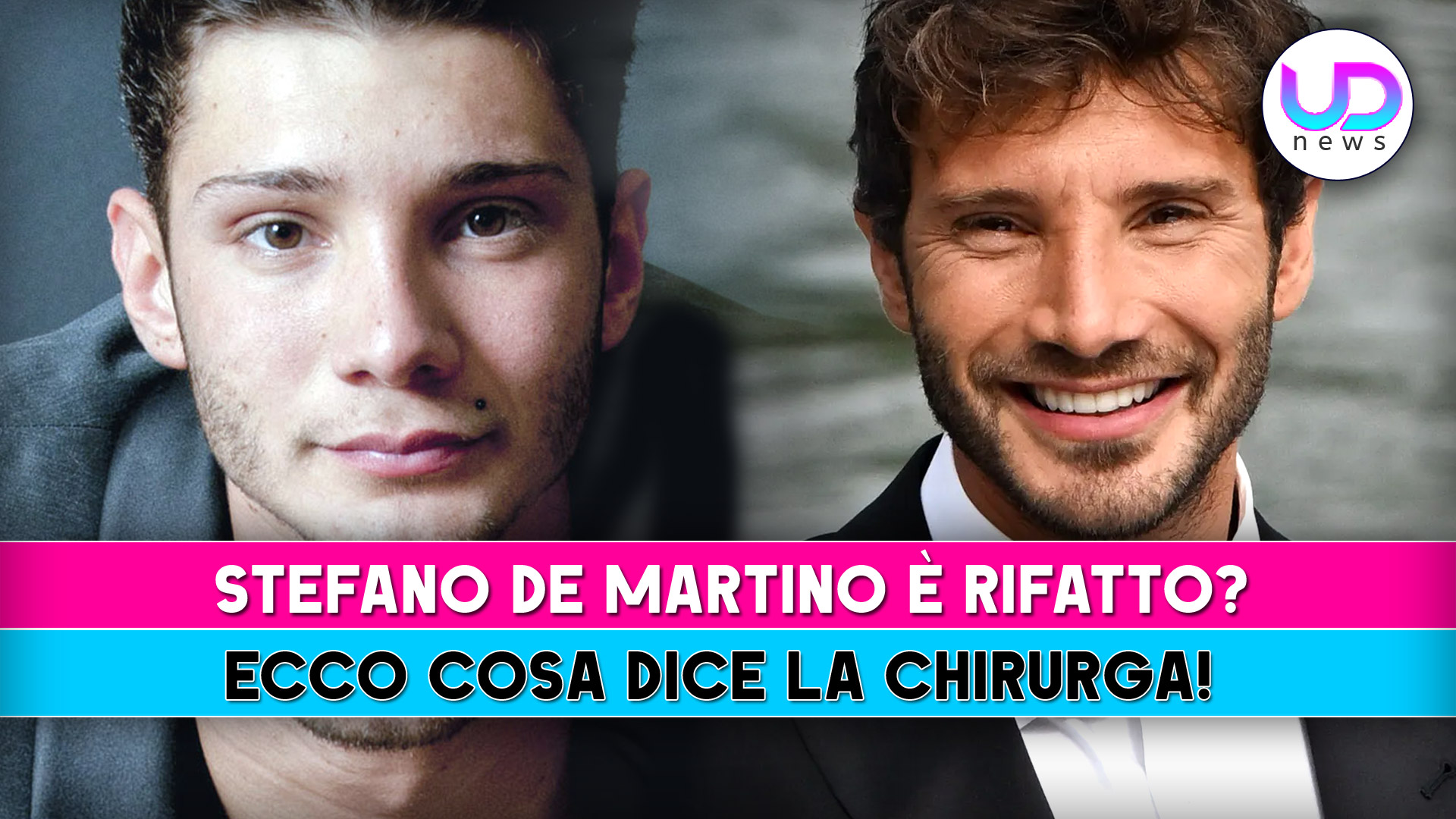 stefano de martino e8217 rifatto ecco cosa dice la chirurga plastica